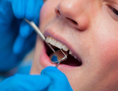 Periodontitis Explained: Recognizing the Signs and Exploring Treatment Solutions