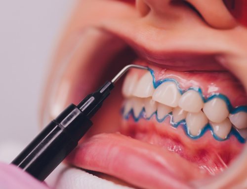 Why Skipping Dental Cleanings Could Be Your Biggest Mistake