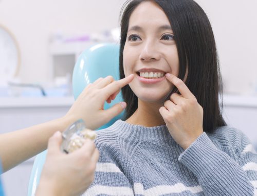 Dental Lumineers: Everything You Need to Know Before You Book